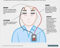 Transcranial Stimulation Concepts