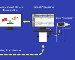 NeuroFeedback