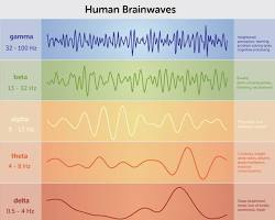 NeuroFeedback